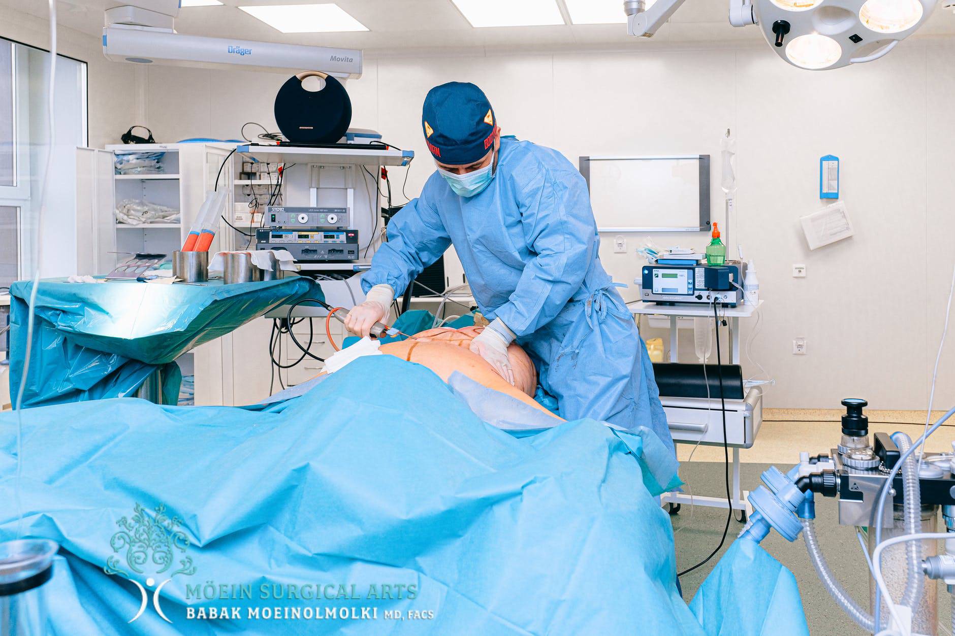 Belly fat loss surgery