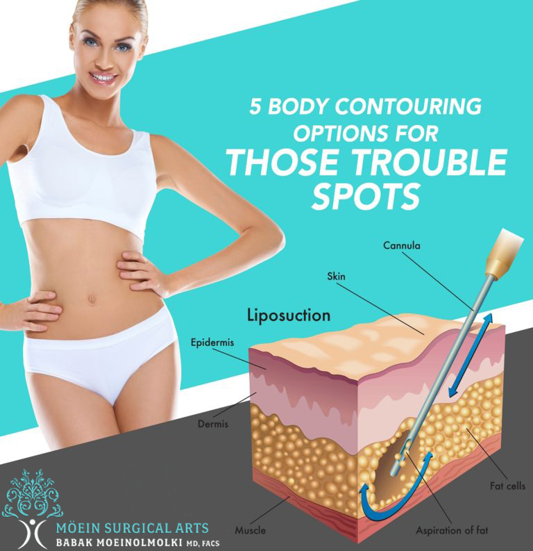 5 BODY CONTOURING OPTIONS FOR THOSE TROUBLE SPOTS