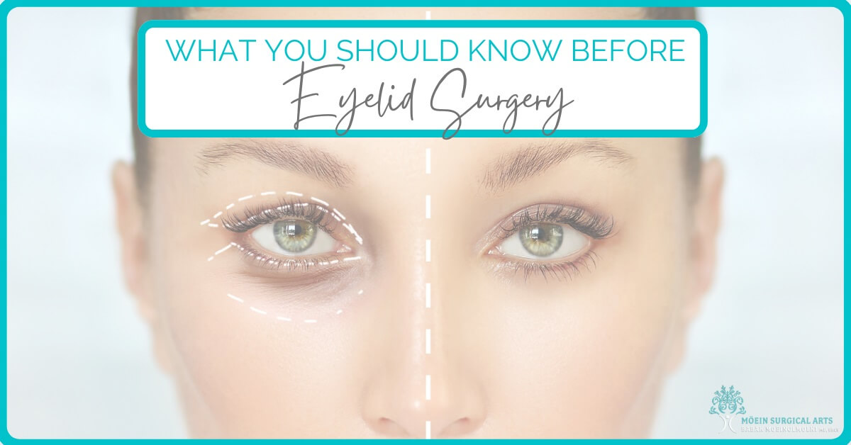 Blepharoplasty