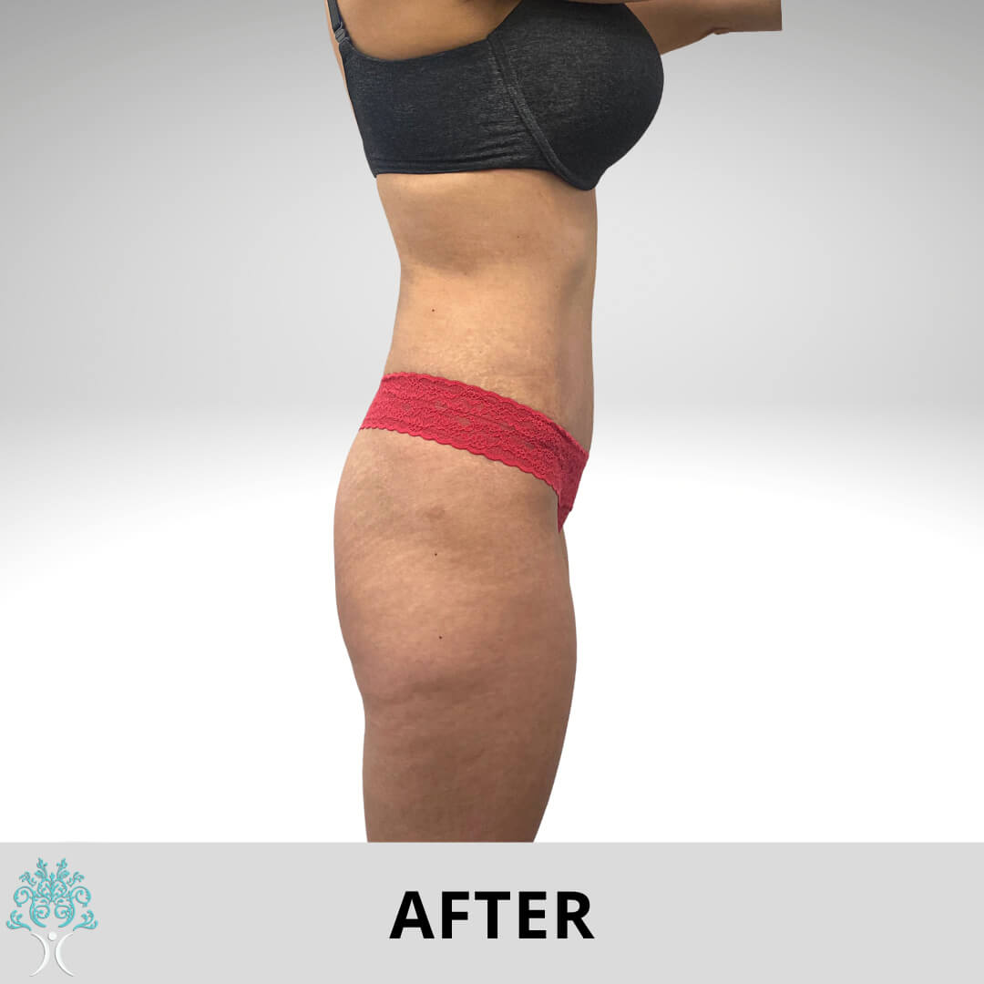 Mamy makeover surgery after