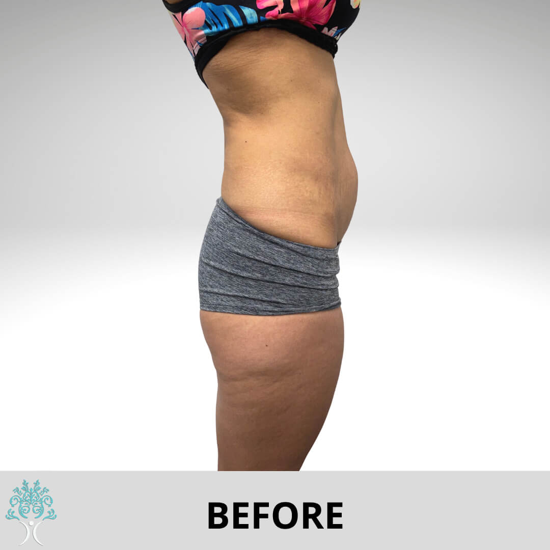 Mamy makeover surgery before