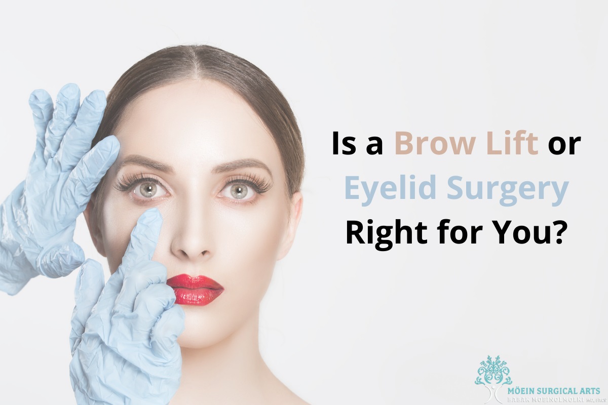 Eyelid-Surgery-Los-Angeles CA