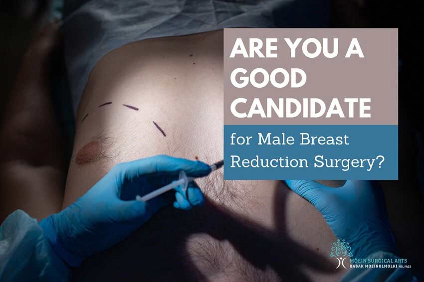 Male Breast Reduction Surgery in Los Angeles, CA