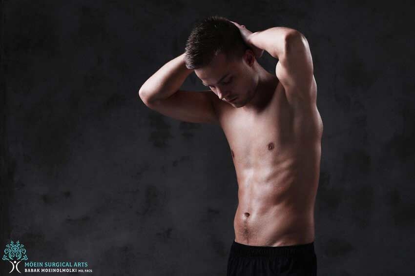 MALE BREAST REDUCTION