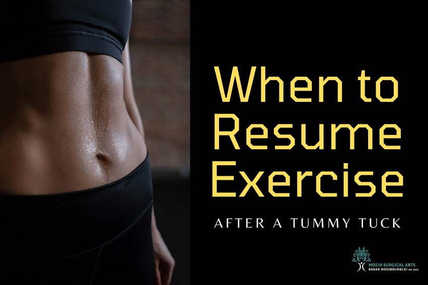Resuming Exercise After Tummy Tuck in Los Angeles CA MSA