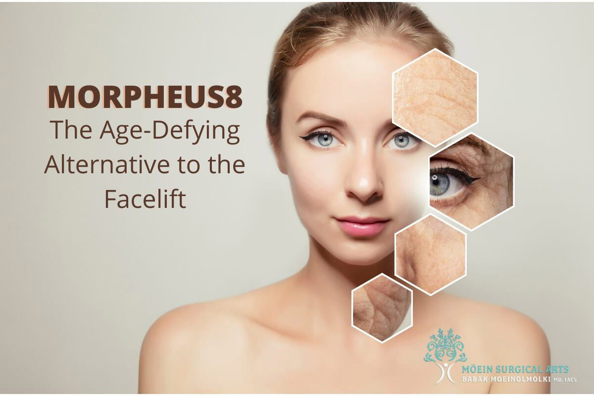 Morpheus8: Alternate to Facelift in LA