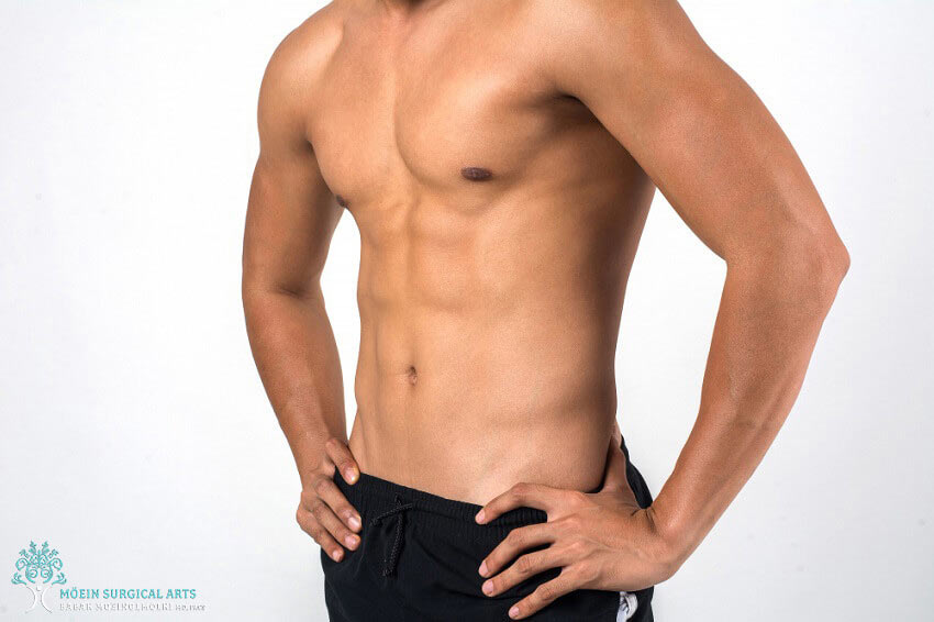 Liposuction for Men