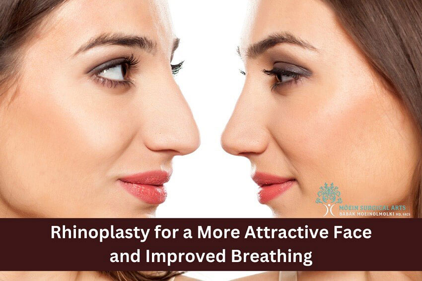 Rhinoplasty for a More Attractive Face and Improved Breathing