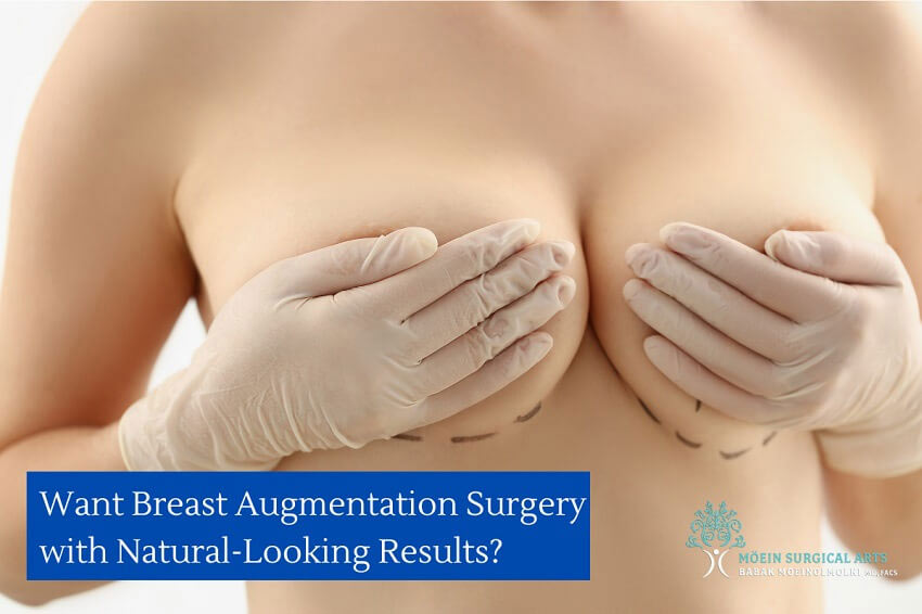 Breast Augmentation Surgery with Natural Results in Los Angeles, CA
