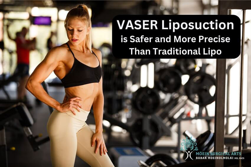 VASER is Safer and More Precise Than Trad Lipo Los Angeles, CA